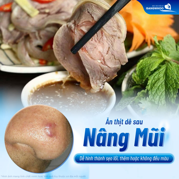 Nâng mũi có ăn thịt dê được không? Có cần lưu ý gì không?