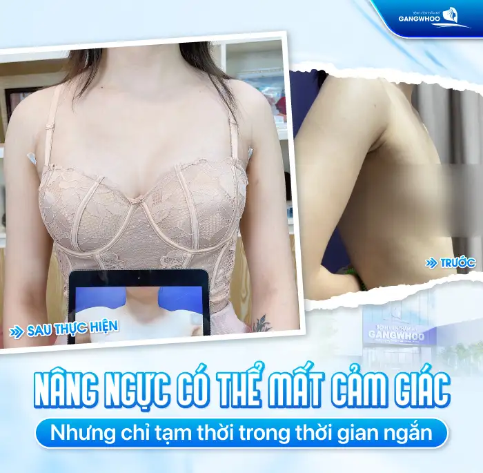Sau nâng ngực có bị mất cảm giác không? Nguyên nhân do đâu?