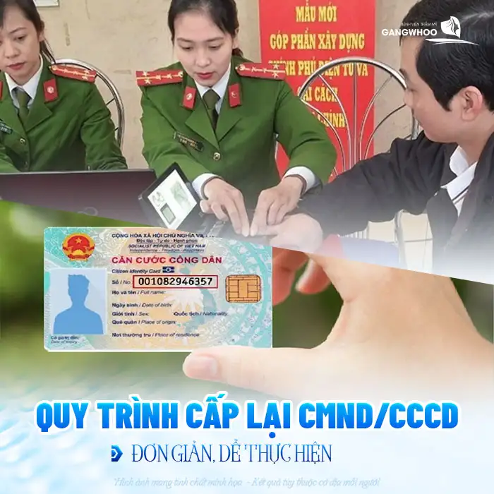 Nâng mũi có cần làm lại CMND không? Thủ tục như thế nào?