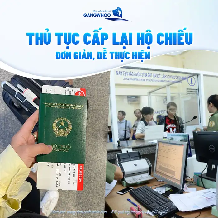 Nâng mũi có cần phải làm lại hộ chiếu, passport không?