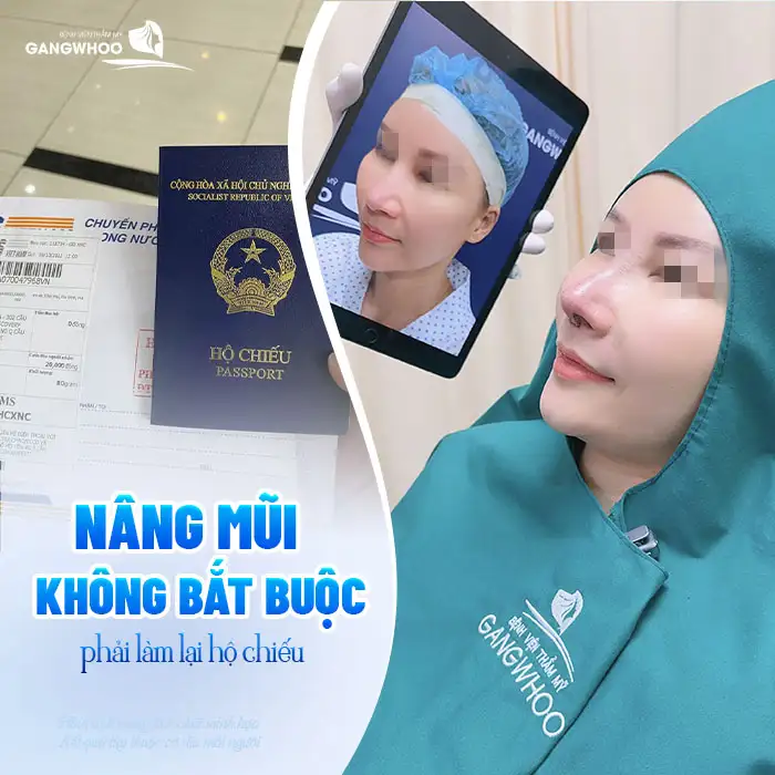 Nâng mũi có cần phải làm lại hộ chiếu, passport không?