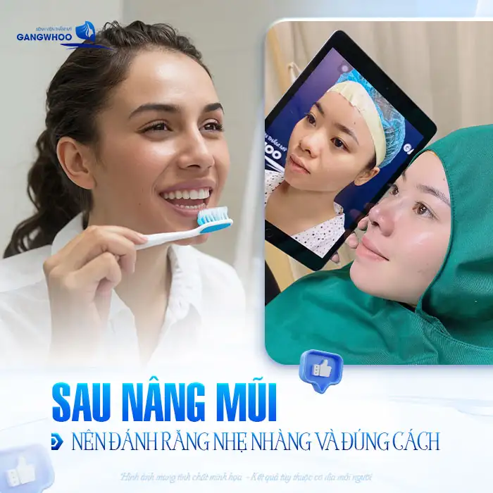 Nâng mũi có đánh răng được không? Cần lưu ý gì khi đánh răng