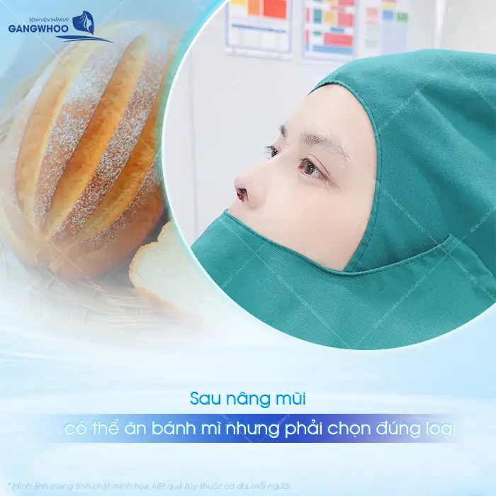 Nâng mũi có được ăn bánh mì không? Có cần phải kiêng cử?
