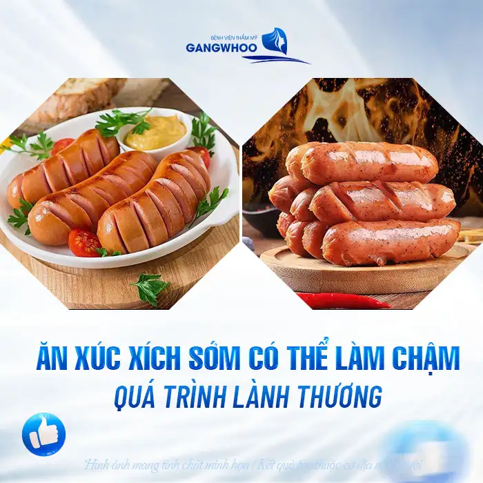 Nâng mũi có được ăn xúc xích không? Cần tránh những loại thực phẩm nào sau nâng mũi?
