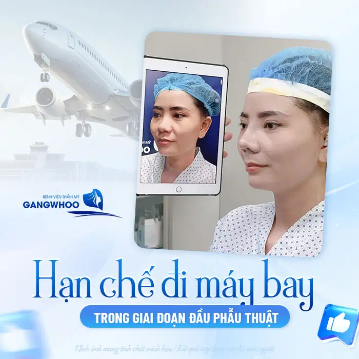 Nâng mũi có được đi máy bay sau bao lâu? Cần lưu ý gì?