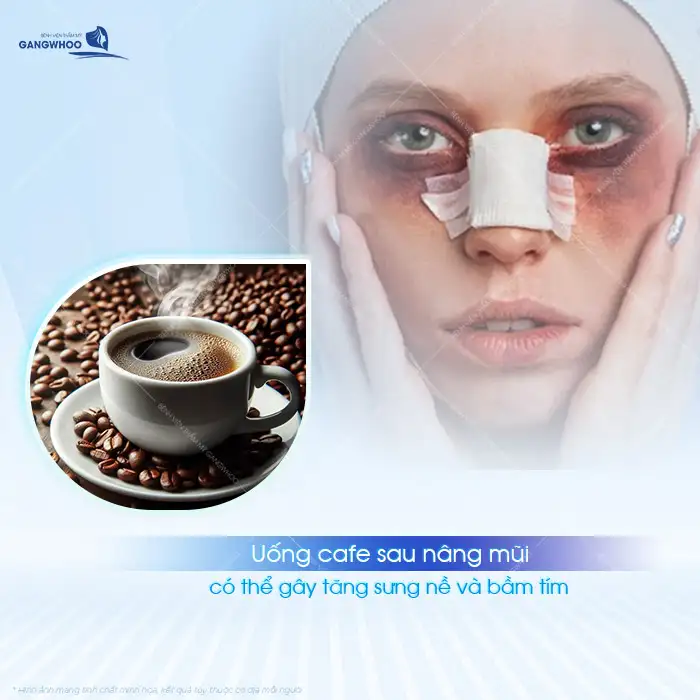 Nâng mũi có được uống cafe không? Có ảnh hướng đến vết thương sau nâng mũi?