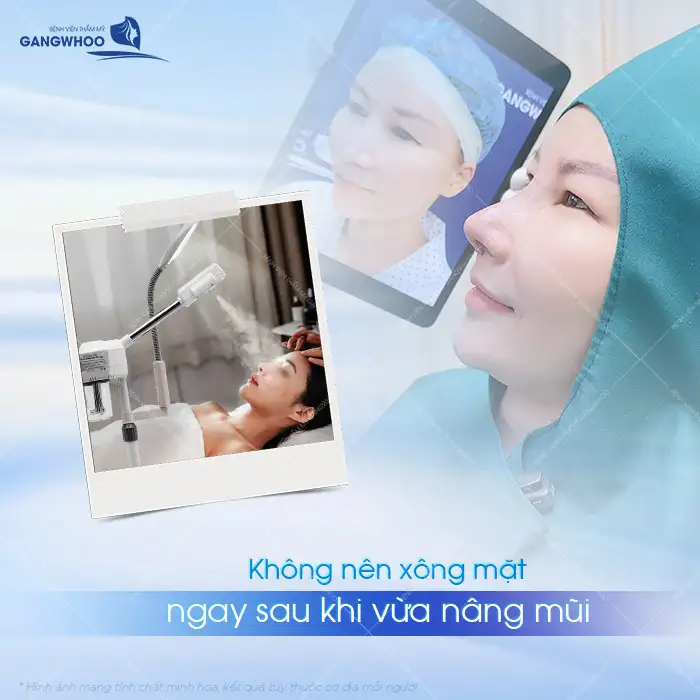 Nâng mũi có được xông mặt sau khi phẫu thuật không? Cần lưu ý những gì?