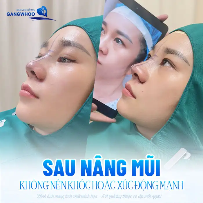 Nâng mũi có được khóc không? Có ảnh hưởng đến mũi sau nâng không?