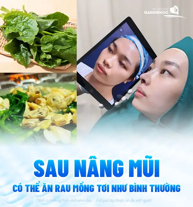 Sau nâng mũi có nên ăn rau mồng tơi không? Có nên kiêng không?