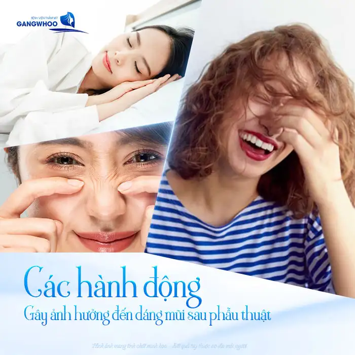 Nâng mũi có được ngáp không? Có ảnh hưởng đến dáng mũi không?