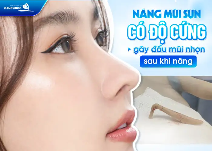 Sau nâng mũi đầu mũi bị nhọn nguyên nhân do đâu? Cách xử lý như thế nào?