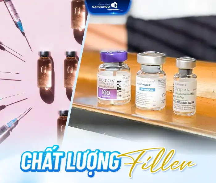 Nâng mũi filler giữ được bao lâu? Bao lâu thì tan?