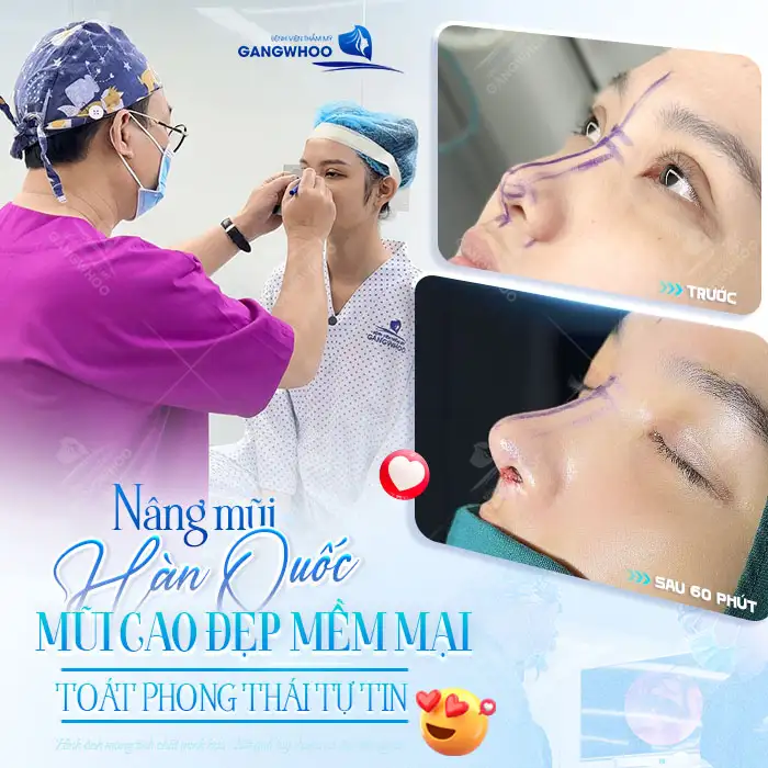 Nâng mũi Hàn Quốc ở đâu đẹp? Top 9 Địa Chỉ uy tín, giá tốt