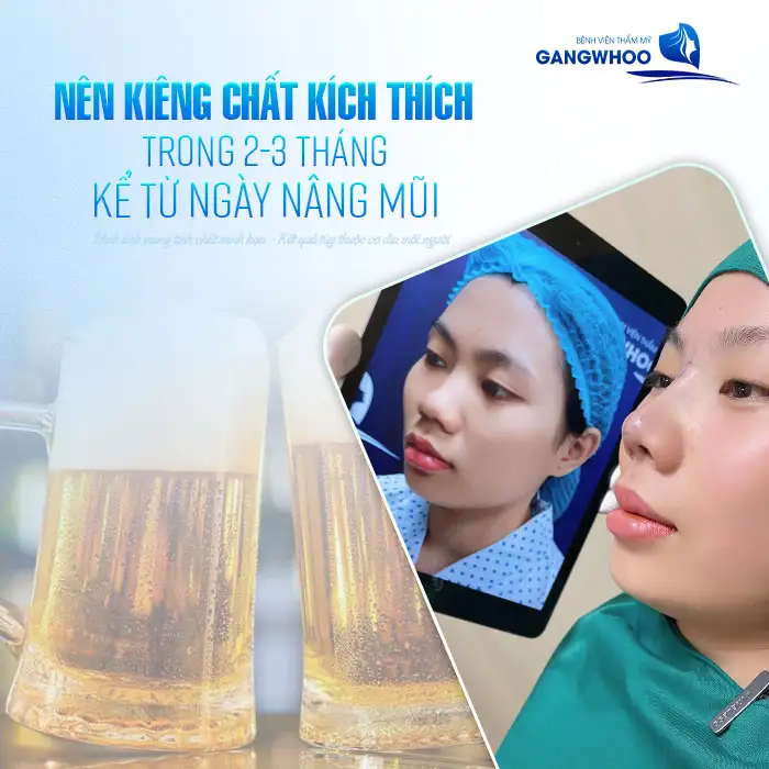 Nâng mũi kiêng chất kích thích bao lâu? Cần lưu ý gì khi sử dụng