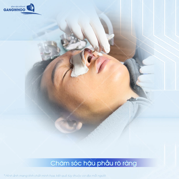 Nâng mũi nam ở đâu đẹp, uy tín tại TPHCM? Top 7 địa chỉ tham khảo