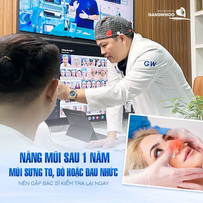 Nâng mũi sau 1 năm bị sưng có nguy hiễm không? Cách xử lý như thế nào?