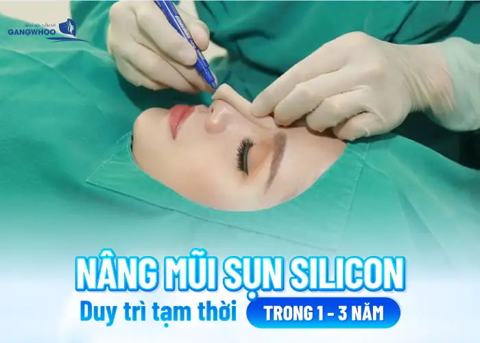 Nâng mũi Silicon được bao lâu? Duy trì được vĩnh viễn không?