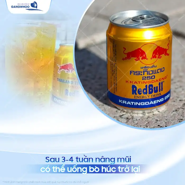 Nâng mũi uống bò húc được không? Có cần phải kiêng không?