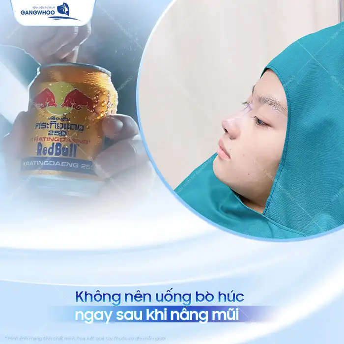 Nâng mũi uống bò húc được không? Có cần phải kiêng không?