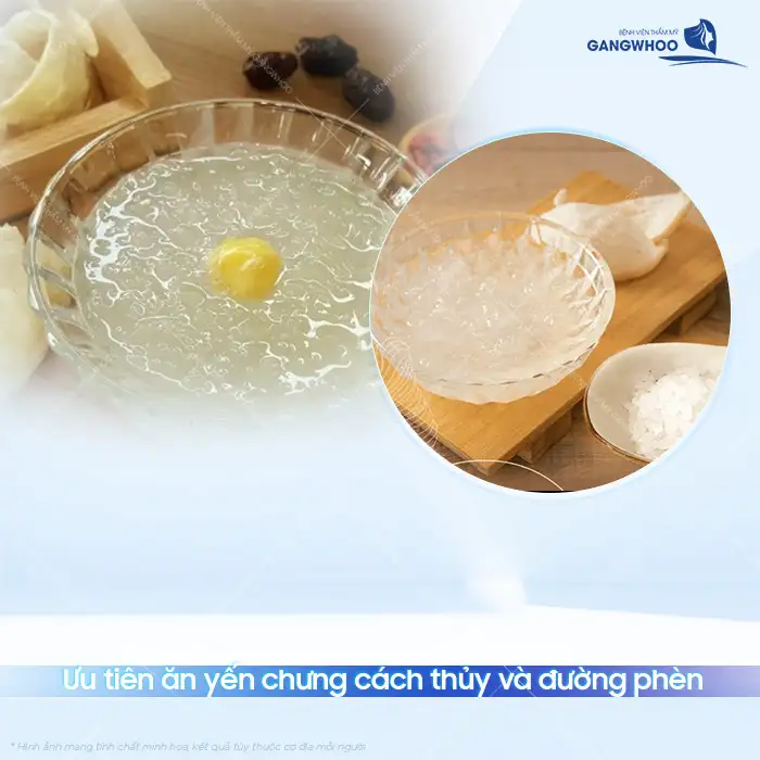 Nâng mũi ăn yến được không? Những lưu ý khi sử dụng