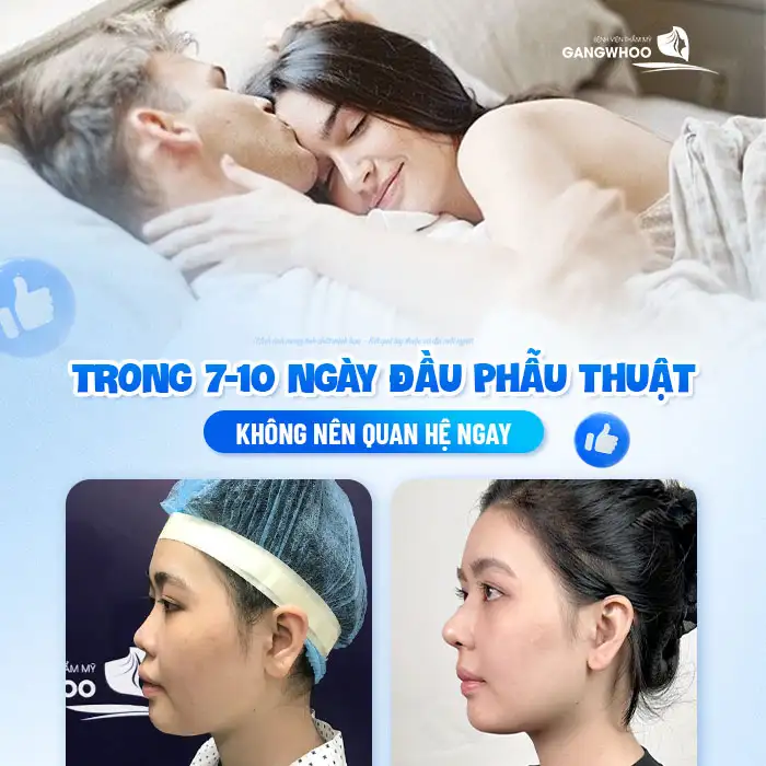 Nâng mũi xong có quan hệ được không? Có cần phải kiêng