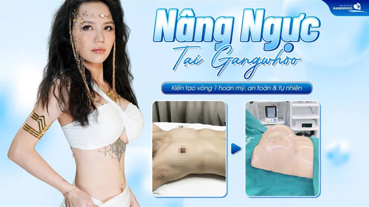 Nâng Ngực Tại Gangwhoo – Kiến Tạo Vòng 1 Hoàn Mỹ, An Toàn & Tự Nhiên 1 Nâng Ngực Tại Gangwhoo – Kiến Tạo Vòng 1 Hoàn Mỹ, An Toàn & Tự Nhiên