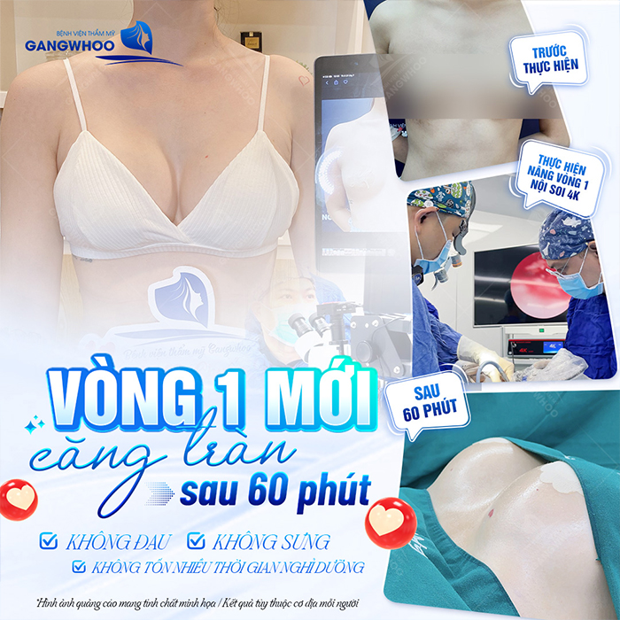 Nâng ngực bằng mỡ tự thân được bao lâu? Cách chăm sóc sau khi thực hiện