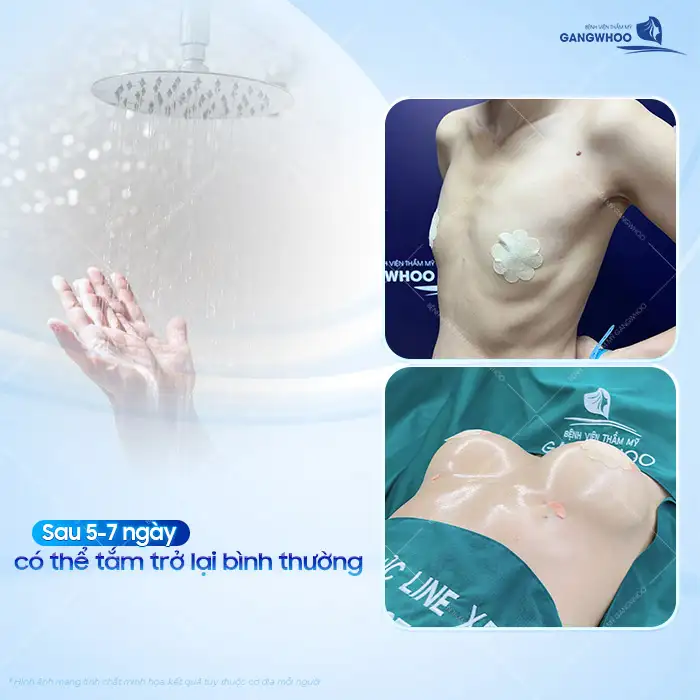 Nâng ngực bao lâu được tắm? Những lưu ý khi chăm sóc ngực sau nâng