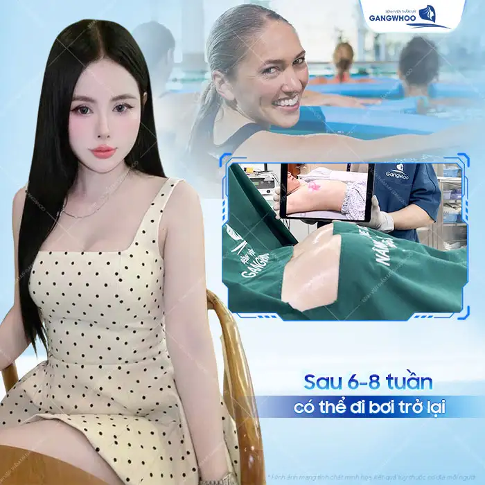 Nâng ngực bao lâu thì đi bơi được? Những lưu ý khi bơi?