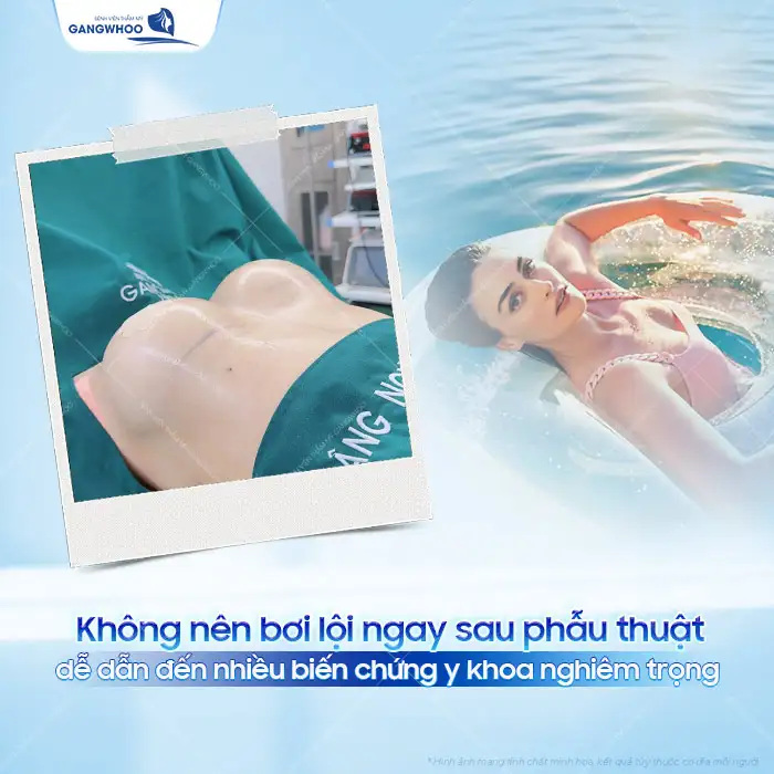 Nâng ngực bao lâu thì đi bơi được? Những lưu ý khi bơi?