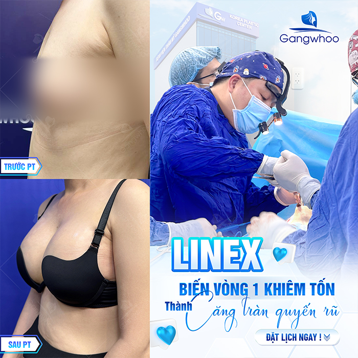 Nâng ngực bao lâu thì lành hẳn? Các giai đoạn hồi phục