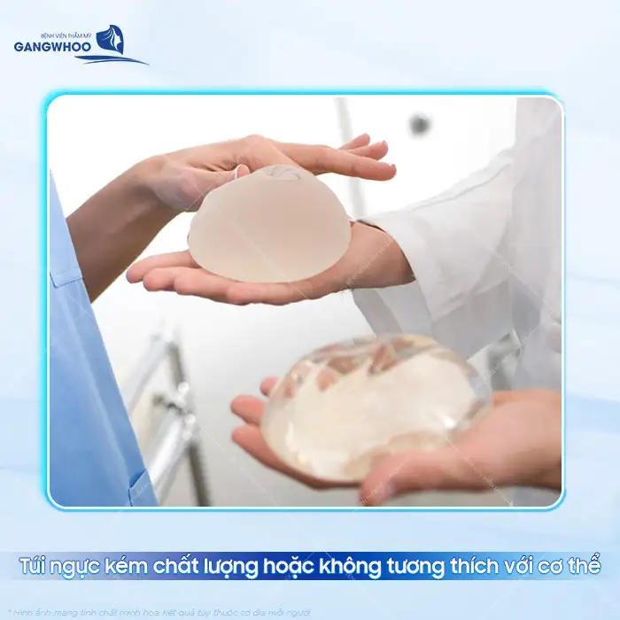 Nguyên nhân nâng ngực bị lệch là gì? Cách khắc phục ra sao?