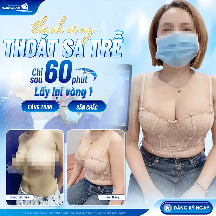 5+ Cách nâng ngực chảy xệ sau sinh hiệu quả, an toàn