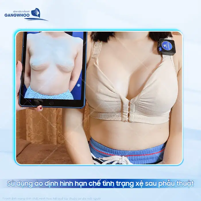Nâng ngực cho con bú có bị xệ không? Cách cho con bú đúng cách