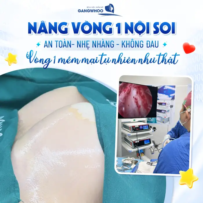 Nâng ngực cho nam giới là gì? Có gì khác so với nâng ngực nữ giới