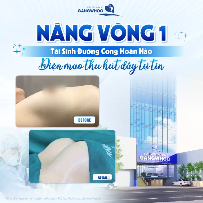 Nâng ngực cho nam giới là gì? Có gì khác so với nâng ngực nữ giới
