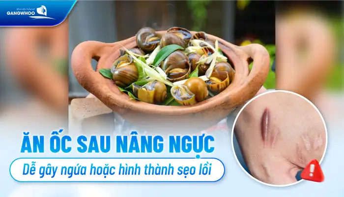 Nâng ngực có được ăn ốc không? Vì sao cần kiêng ăn ốc