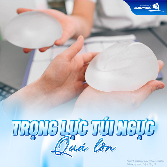 Nâng ngực có bị chảy xệ không? Cách khắc phục như thế nào?