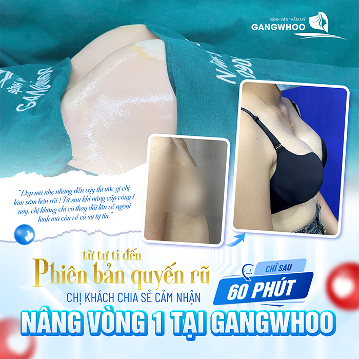 Nâng ngực có đau không? Nâng ngực bao lâu thì hết đau?