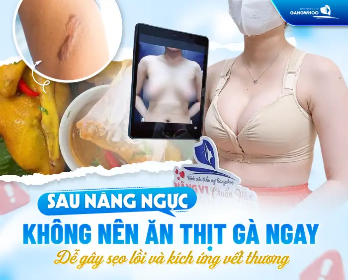 Nâng ngực có được ăn thịt gà không? Kiêng thịt gà trong bao lâu?