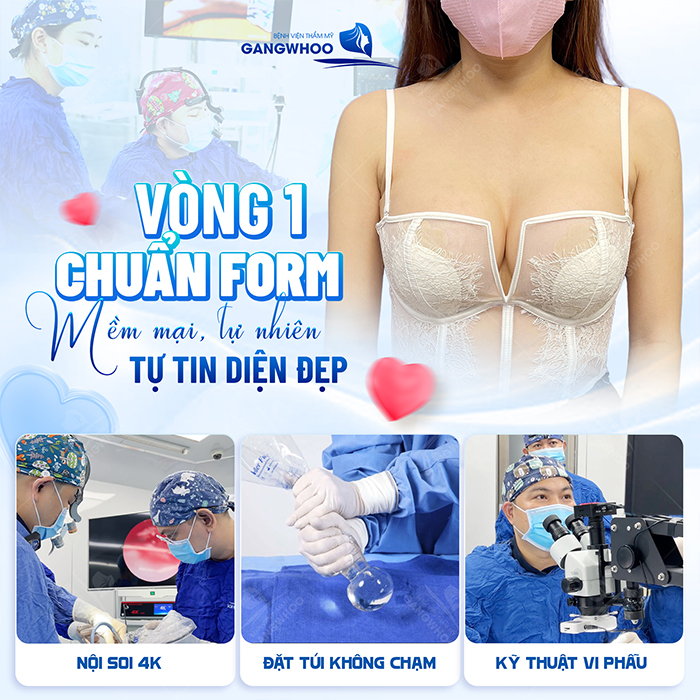 Nâng ngực có được vĩnh viễn không? Thời gian duy trì bao lâu?