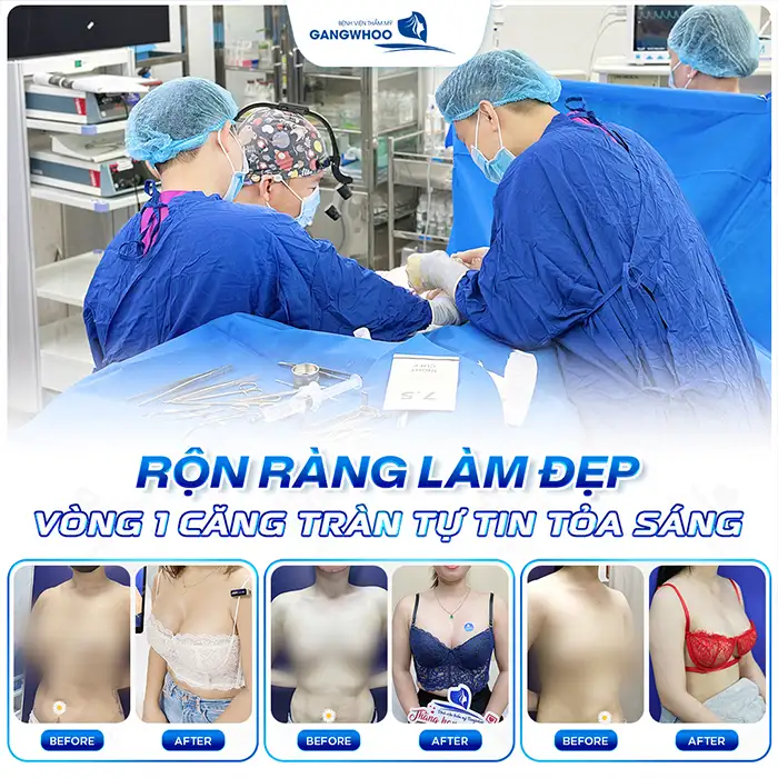 Nâng ngực có làm giảm tuổi thọ không? Liệu có ảnh hưởng sức khỏe