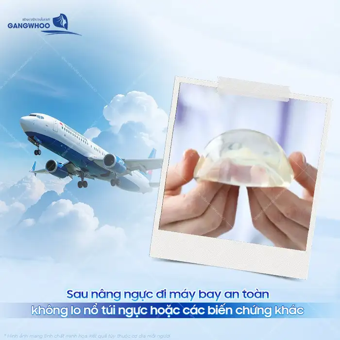 Nâng ngực có đi máy bay được không? Liệu có bị nổ khi đi máy bay