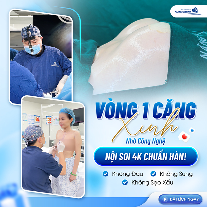 Nâng ngực được bao nhiêu năm? Có duy trì vĩnh viễn không?