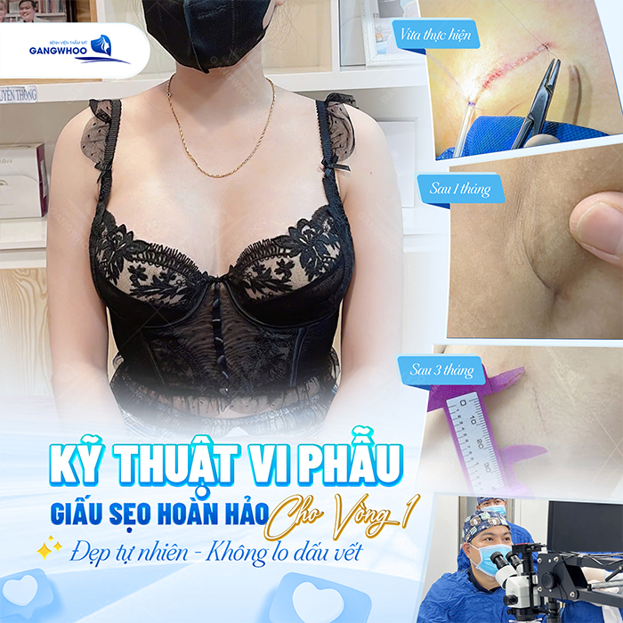 Nâng ngực đường nách là gì? Quy trình thực hiện ra sao?