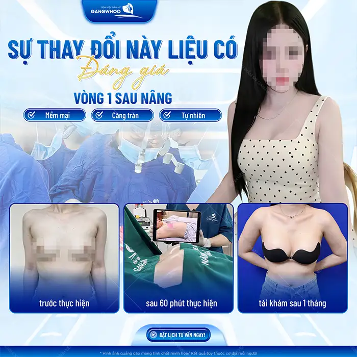 Nâng ngực lần 2 có đau không? Có đảm bảo an toàn cho sức khỏe không?