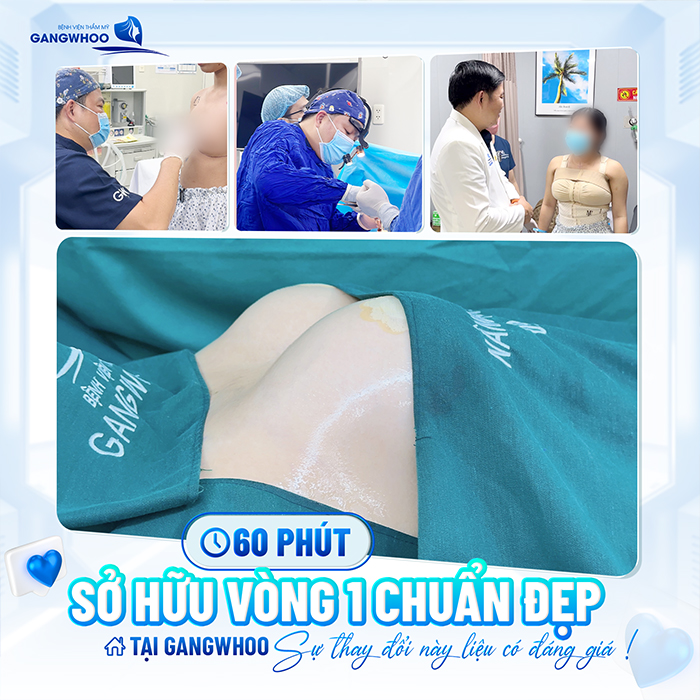 Phương pháp nâng ngực nội soi là gì? Ưu, nhược điểm của phương pháp