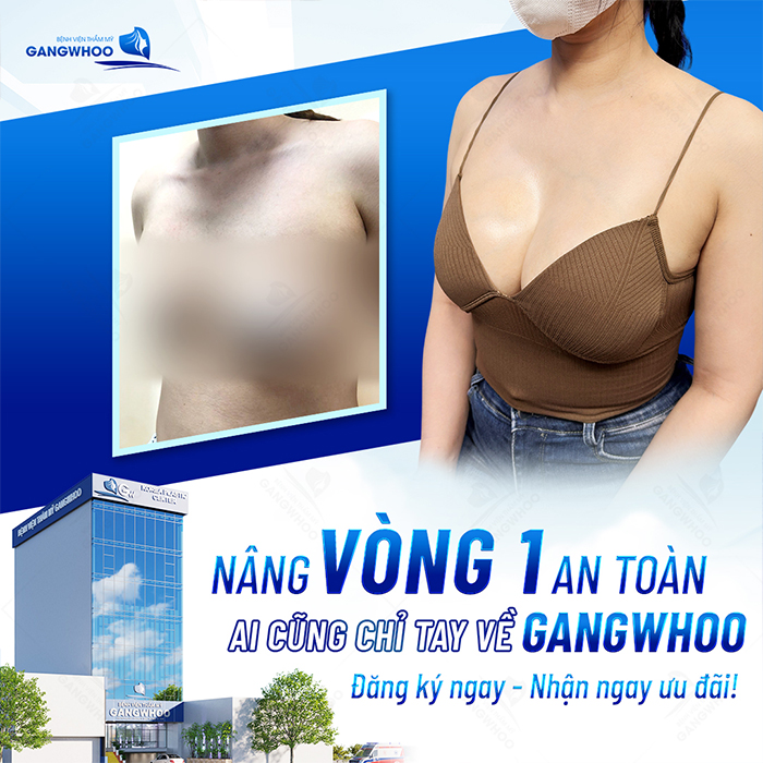 Nâng ngực nội soi qua đường rốn là gì? Có đảm bảo an toàn không?
