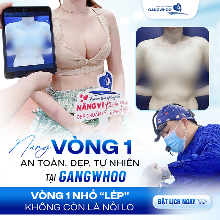 Nâng ngực nội soi qua đường rốn là gì? Có đảm bảo an toàn không?