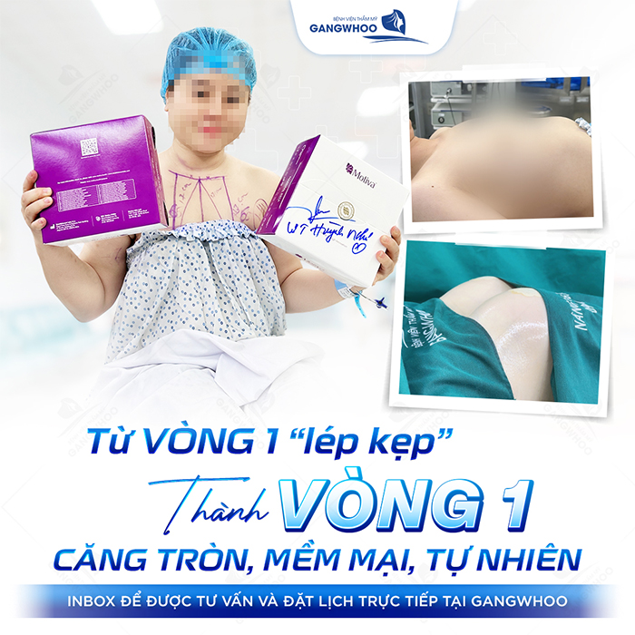 Nâng ngực nội soi qua đường rốn là gì? Có đảm bảo an toàn không?